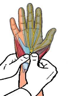 median nerve compression test pressure provocation test|carpal tunnel pressure test.